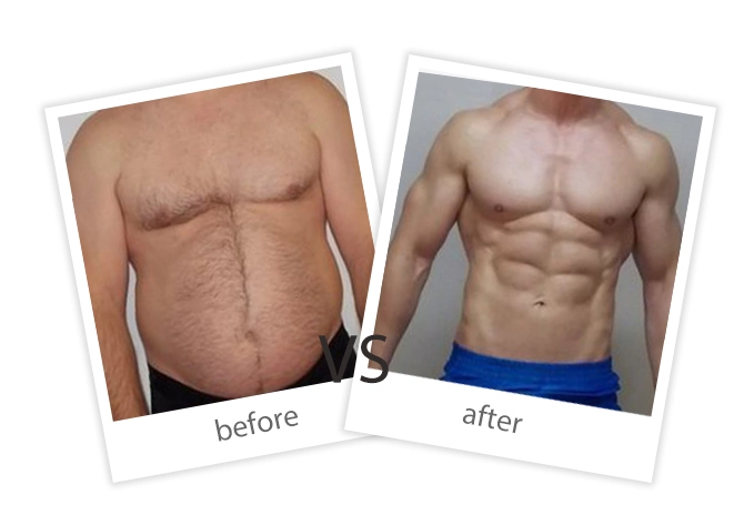 AIRPRITI-Treatment-Weight Loss & Build Muscle-18