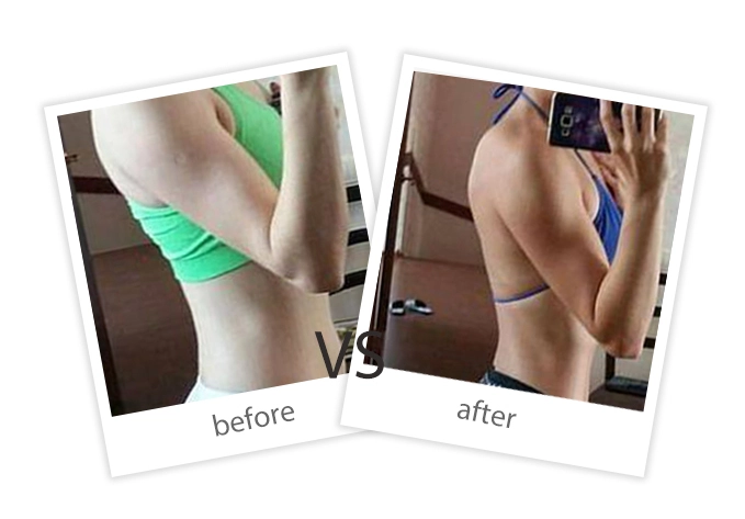 AIRPRITI-Treatment-Weight Loss & Build Muscle-20